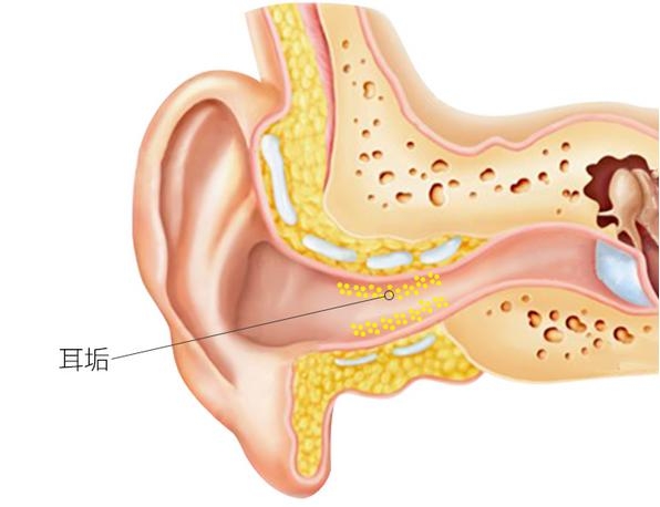 如何正常发音不伤声带 61db284307.jpg