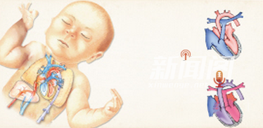 男童心脏动脉长反 竟然还有这种情况