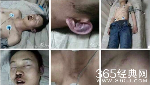 人间惨剧！ 山西运城少年遭6人围殴致死