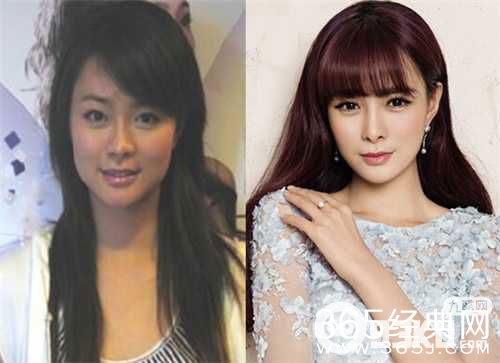 沈梦辰整容了吗？沈梦辰为什么整容？沈梦辰整容前后照对比