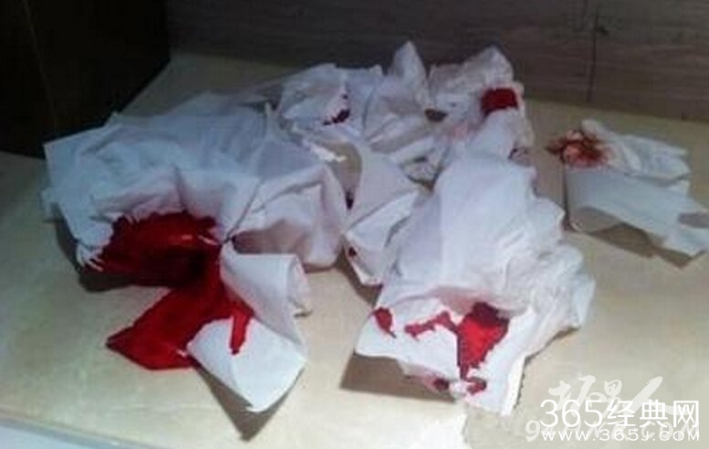 唐嫣自杀原因真相揭秘|图片|视频 唐嫣自杀死了吗