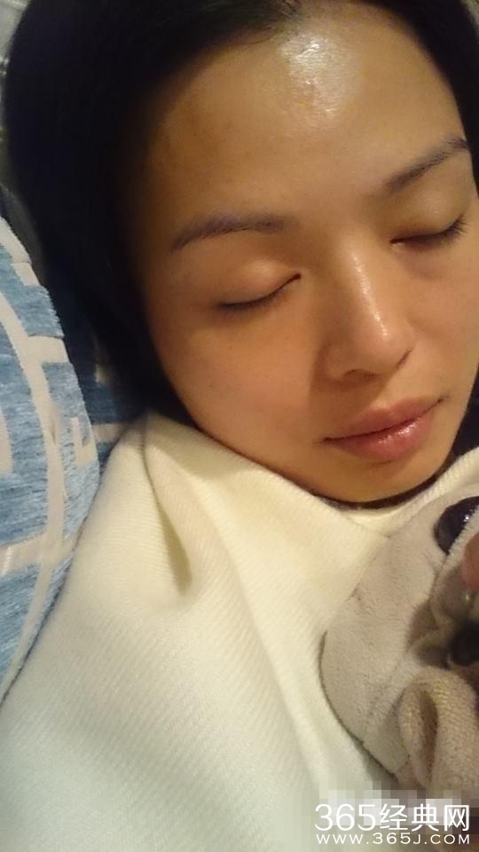 “山鸡”女友患上乳腺癌皮肤癌 一月暴瘦13斤