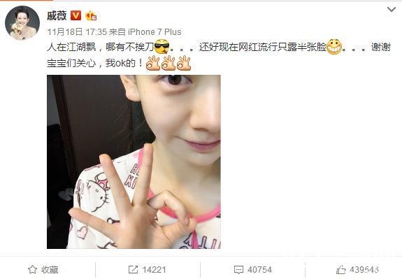 娱乐圈劳模！戚薇缝完针后立即开工，素颜出镜伤痕明显