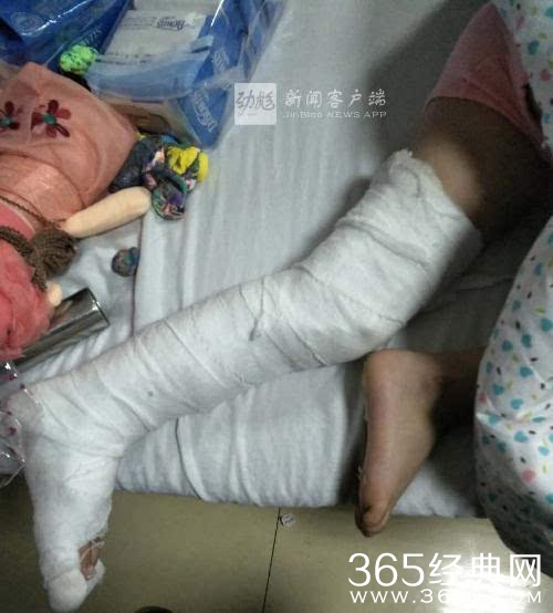 5岁女童遭继母哥哥虐待 9根肋骨骨折