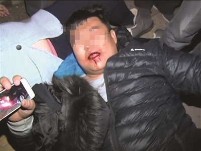 闪了两下远光灯 被七八人暴揍