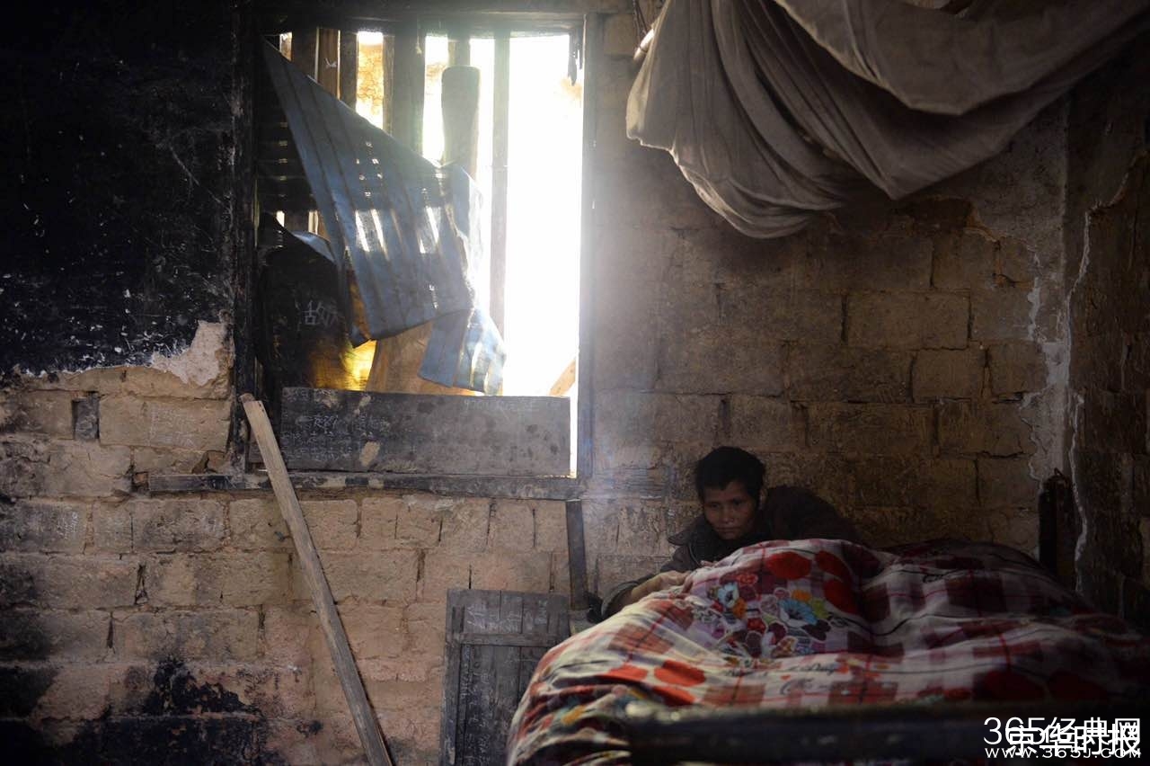 4月大男婴与狗同睡地铺 被咬掉两根手指