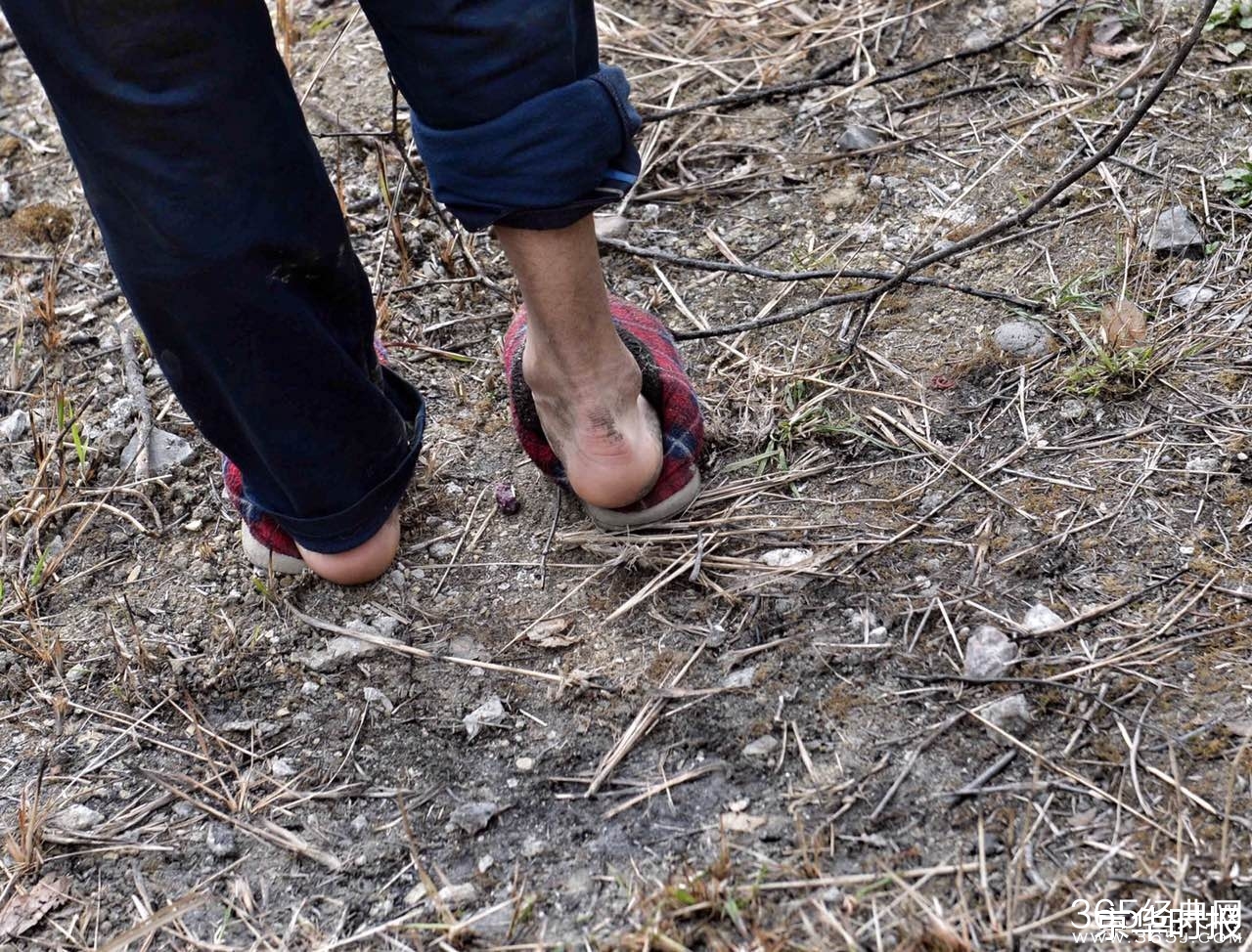 4月大男婴与狗同睡地铺 被咬掉两根手指