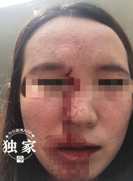 澳洲华人女子当街无辜遇袭视频 Lina个人资料照片