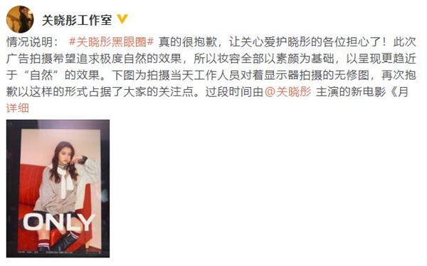 关晓彤回应黑眼圈说了什么?终于真相了,原来是这样!