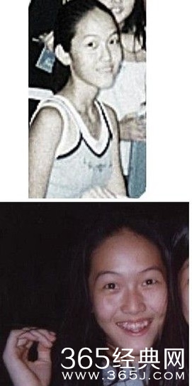 少女时代整容前后对比 画面太美不忍直视