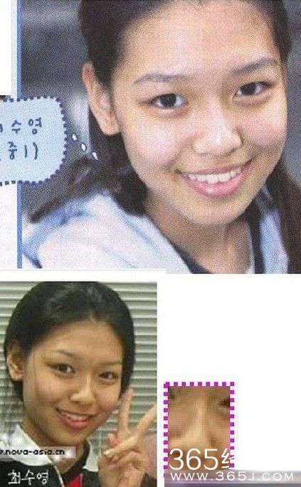 少女时代整容前后对比 画面太美不忍直视