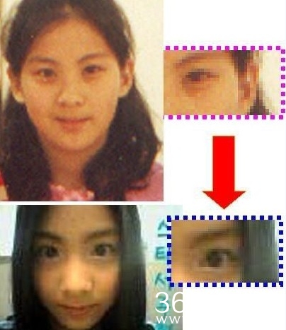 少女时代整容前后对比 画面太美不忍直视