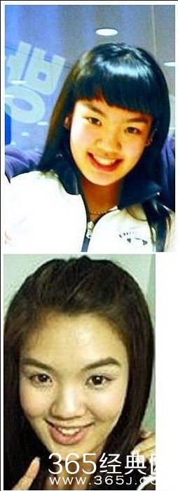 少女时代整容前后对比 画面太美不忍直视