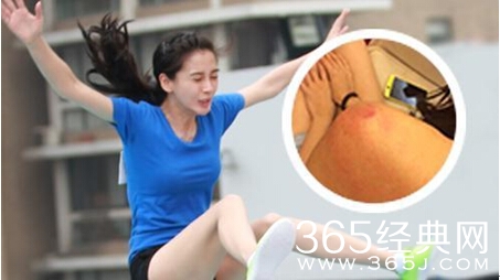 Angelababy录制跑男受伤 黄小明大呼心疼相关图片