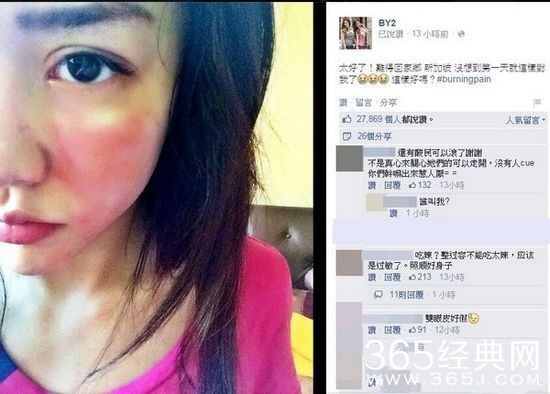 By2的妹妹Yumi晒烂脸照