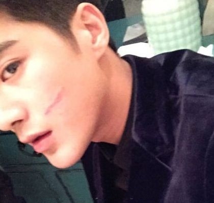 《与星共舞》姜潮脸部受伤是怎么回事 姜潮个人资料介绍