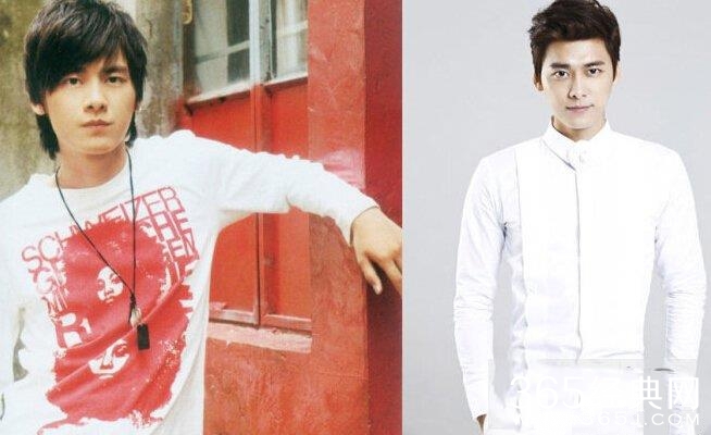 李易峰整容史曝光