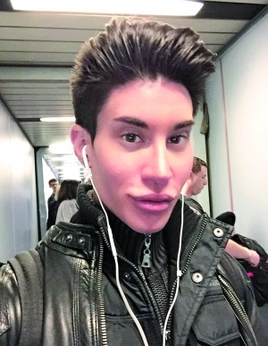 美国男子疯狂整容190次变成芭比男友