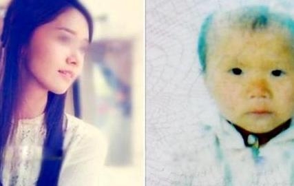 少女逆生长变2岁女婴