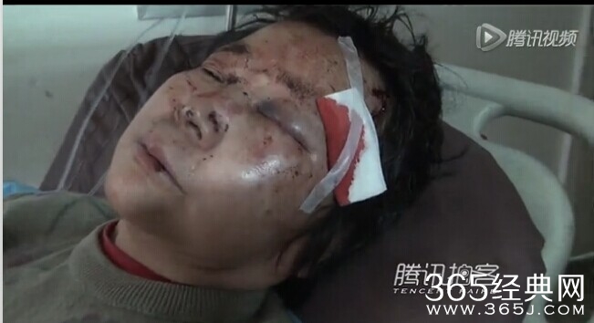 沈阳妇女因口角骑在六旬老太身上暴打老太 大喊我眼睛三万多，你这条命都赔不起