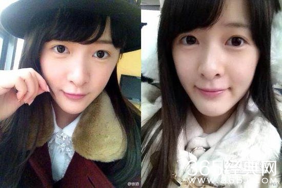 徐娇患良性肿瘤素颜晒自拍_当年假小子如今变美娇娘_365经典网