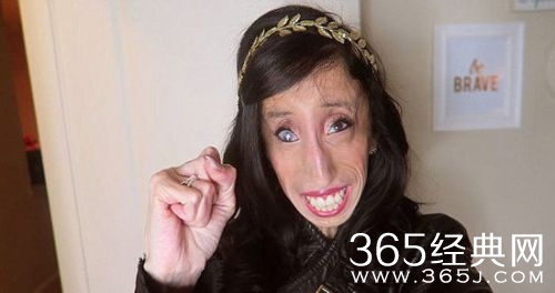 世界上最丑女人利兹维拉斯奎兹个人资料介绍 最丑女人老公照片图片