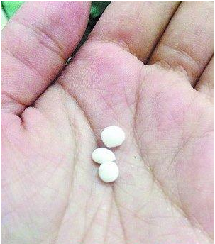 吃生蚝吃出三颗珍珠