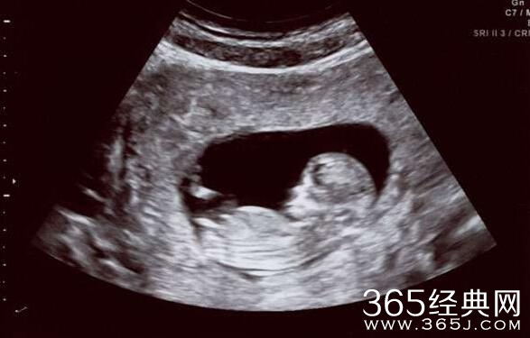 怀孕5个月的孕妇去堕胎，竟然因为怀的是男孩