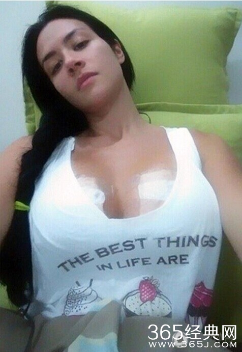 迪奥萨-卡纳莱丝个人资料钢管舞视频 隆胸硅胶发生爆裂(图)