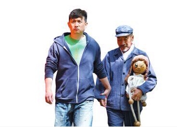 阿兹海默症是什么病症状是什么 阿兹海默症就是老年痴呆症吗