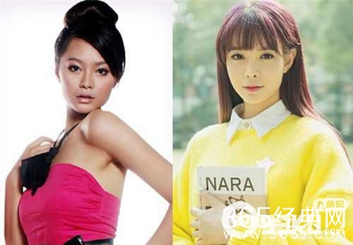 沈梦辰整容了吗？沈梦辰为什么整容？沈梦辰整容前后照对比