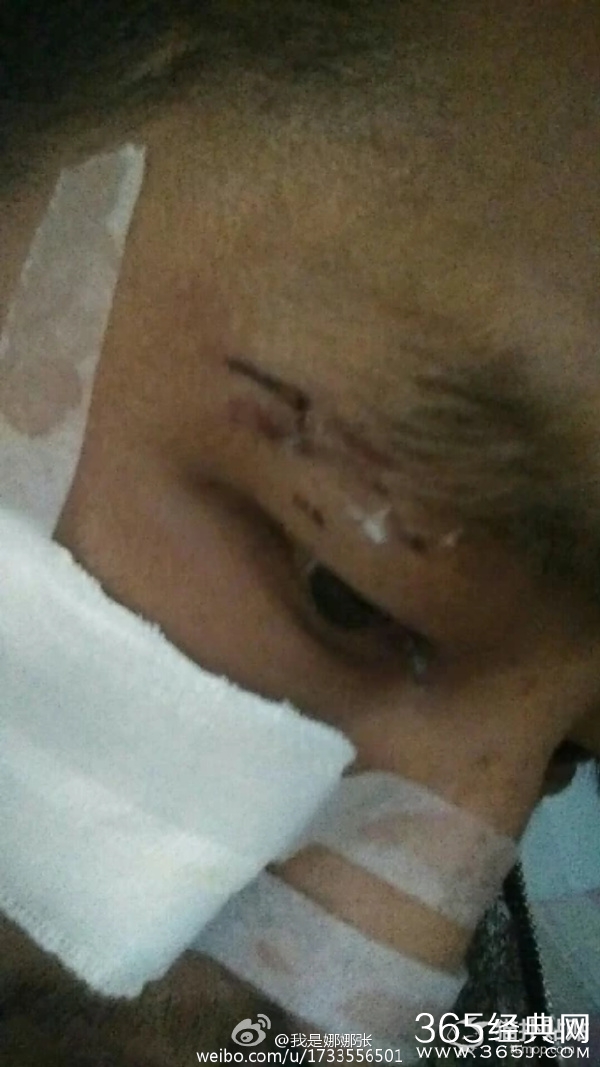 冠希哥惊现坚果摊 涉足相声界之后又做了小买卖