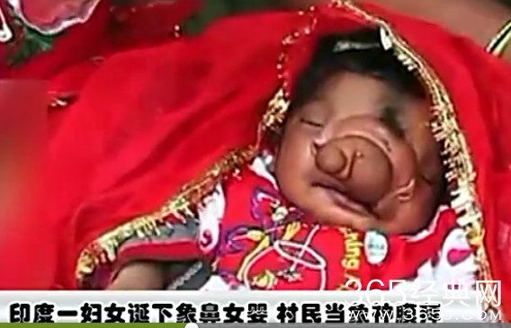 印度一妇女诞下象鼻女婴 村民当象神膜拜