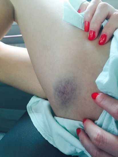 《前往世界的尽头》中姚笛录节目发生了什么事情？ 臀部淤青膝盖渗血是怎么回事