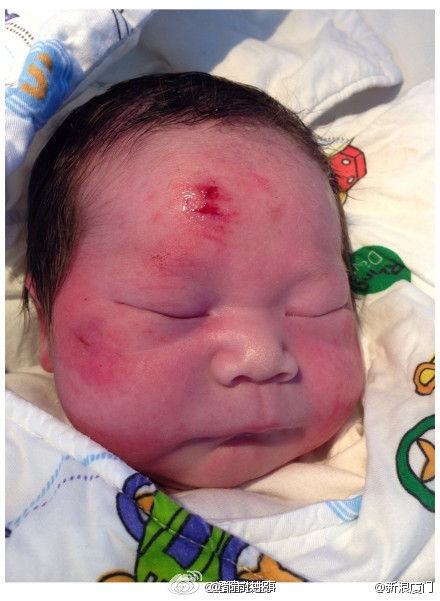 厦门一对夫妻车祸遇难 孕妇腹中胎儿被撞出存活