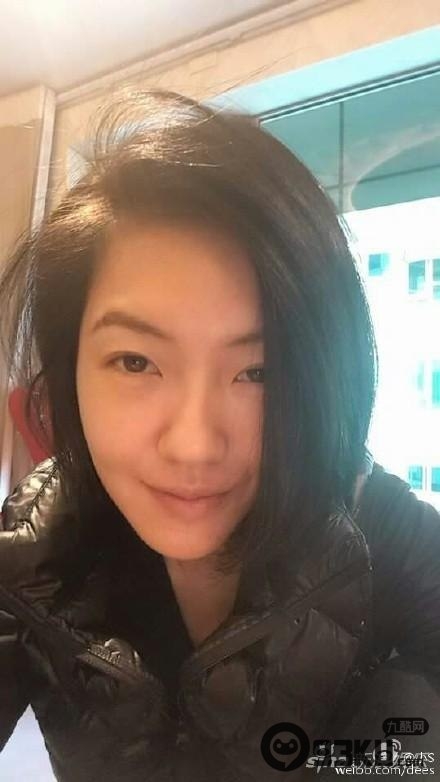 小S左眼眼角瘀伤是怎么回事？小S遭家暴是真的吗？小S老公是谁？