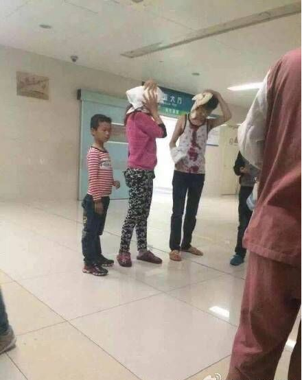 江苏天降巨型冰雹 汽车玻璃遭飞来横祸