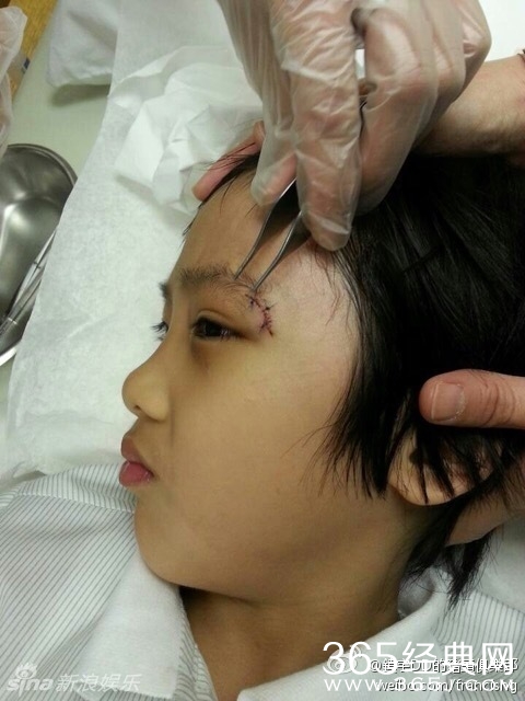 费曼受伤到底和曹格有没有关系