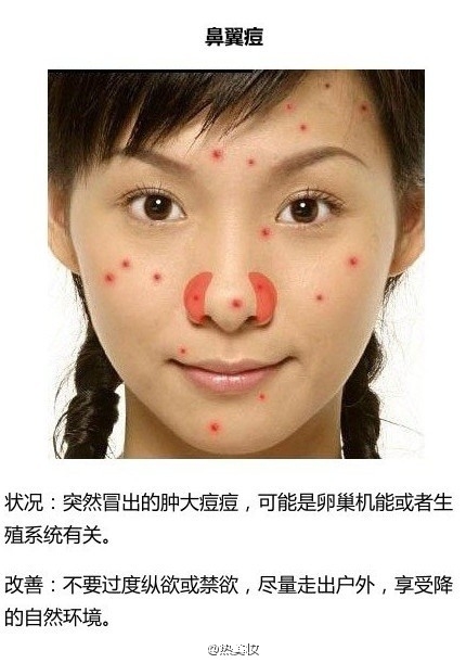 脸上长痘该怎么办？