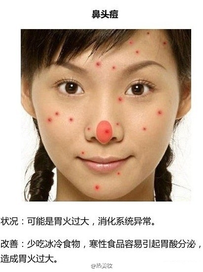 脸上长痘该怎么办？