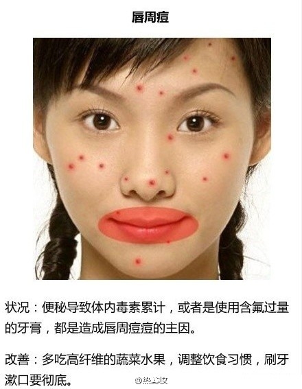 脸上长痘该怎么办？