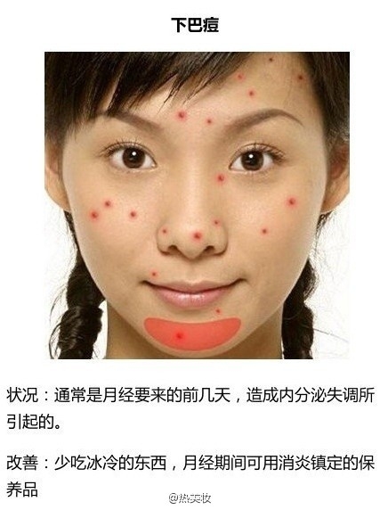 脸上长痘该怎么办？