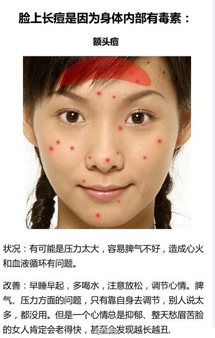 脸上长痘该怎么办？