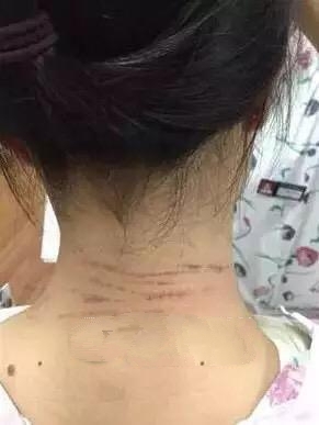 横店剧组人员将护士掐进ICU 被罚拘留13天