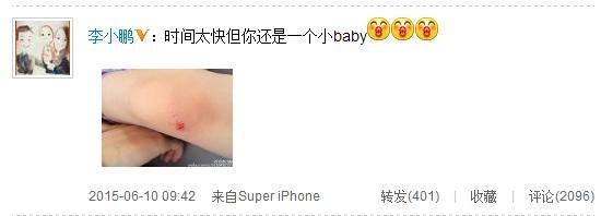 奥莉摔伤捂脸痛哭