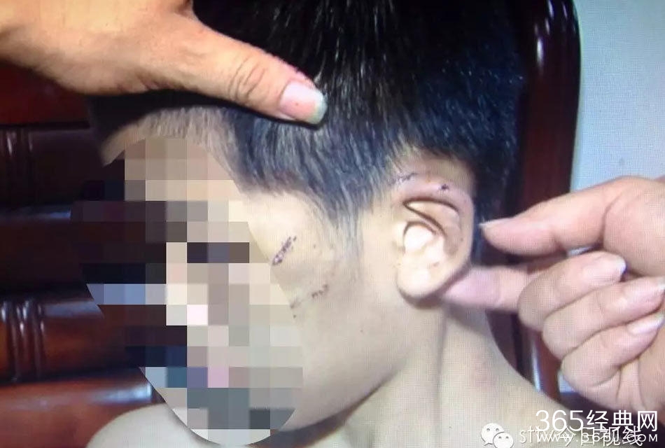 姐弟长期遭生父继母虐打不敢报警  称“不然会死的很惨”