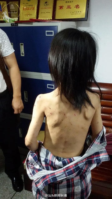 姐弟长期遭生父继母虐打不敢报警  称“不然会死的很惨”