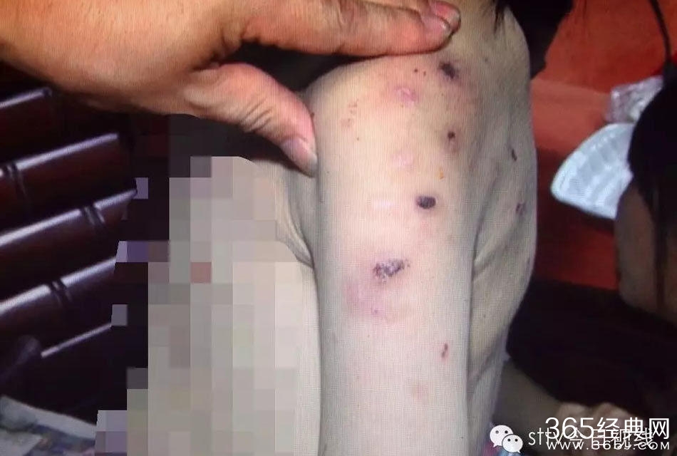 姐弟长期遭生父继母虐打不敢报警  称“不然会死的很惨”