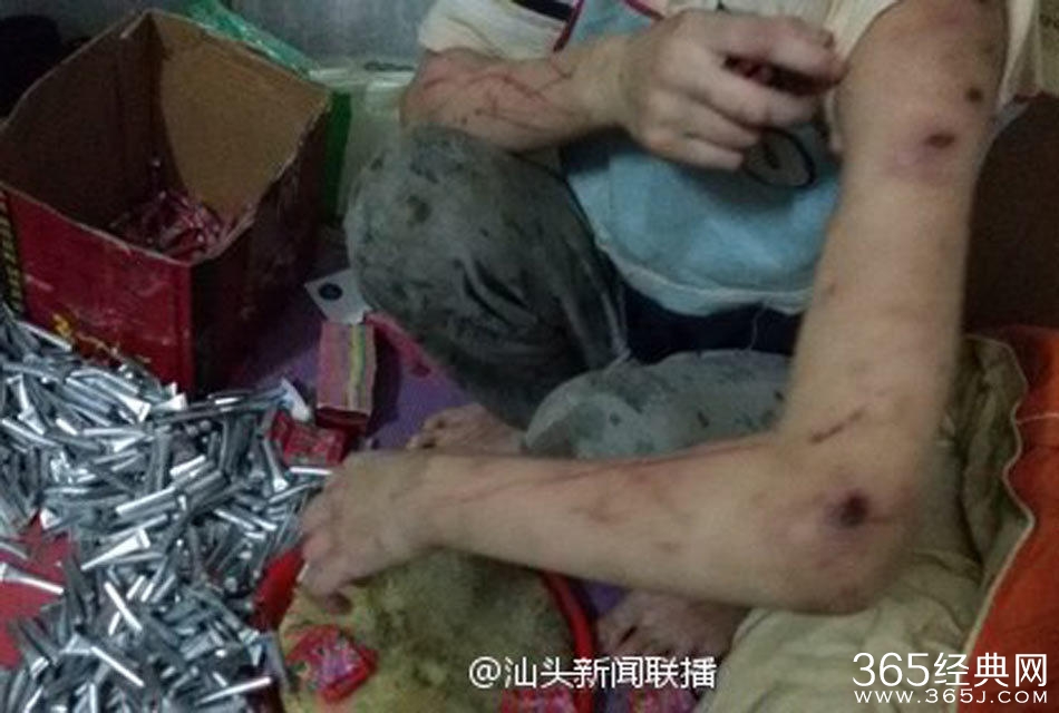 姐弟长期遭生父继母虐打不敢报警  称“不然会死的很惨”