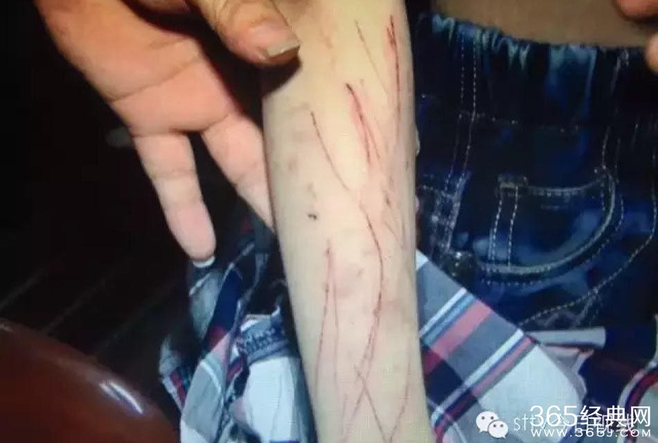 姐弟长期遭生父继母虐打不敢报警  称“不然会死的很惨”